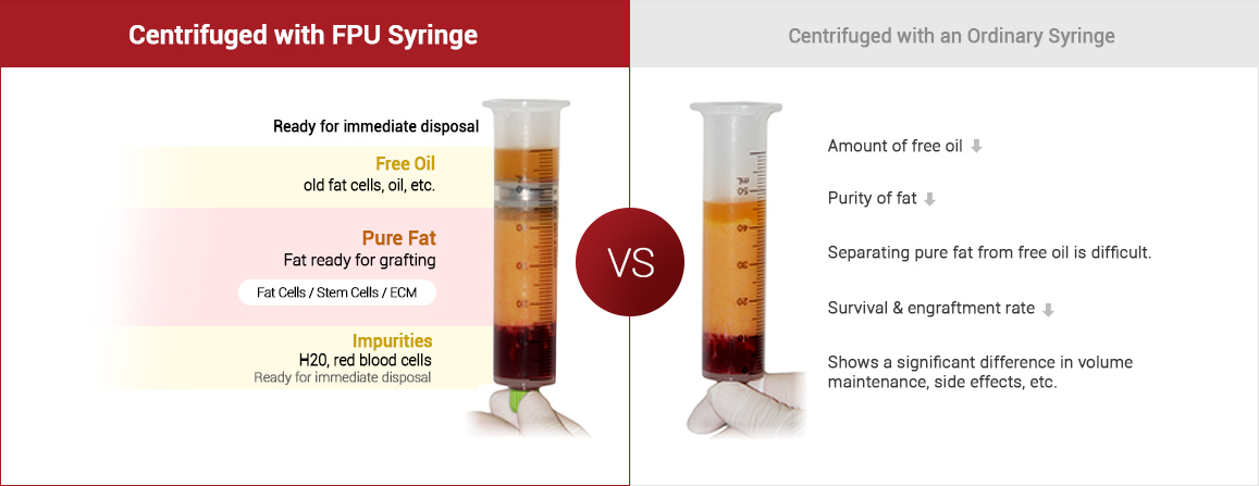 Comparison of Fat Stratification after Centrifugation